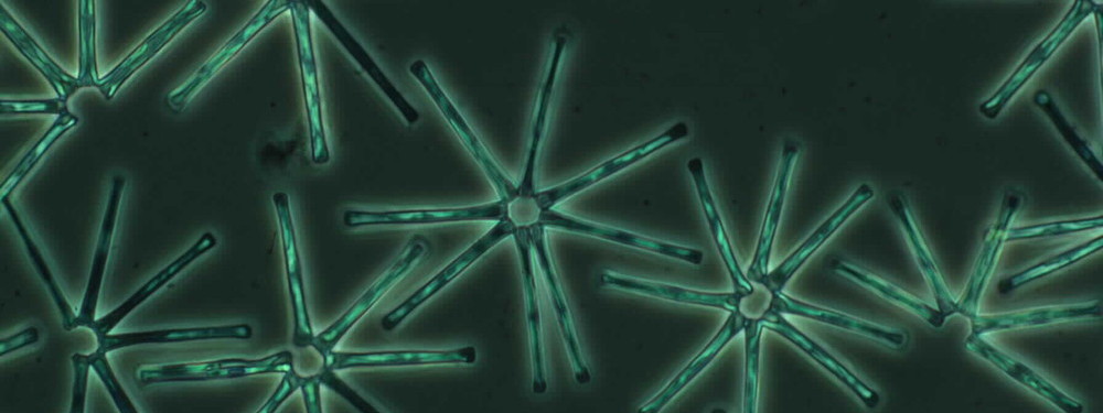 Asterionella formosa CCAP 1005/17 (courtesy of CCAP)